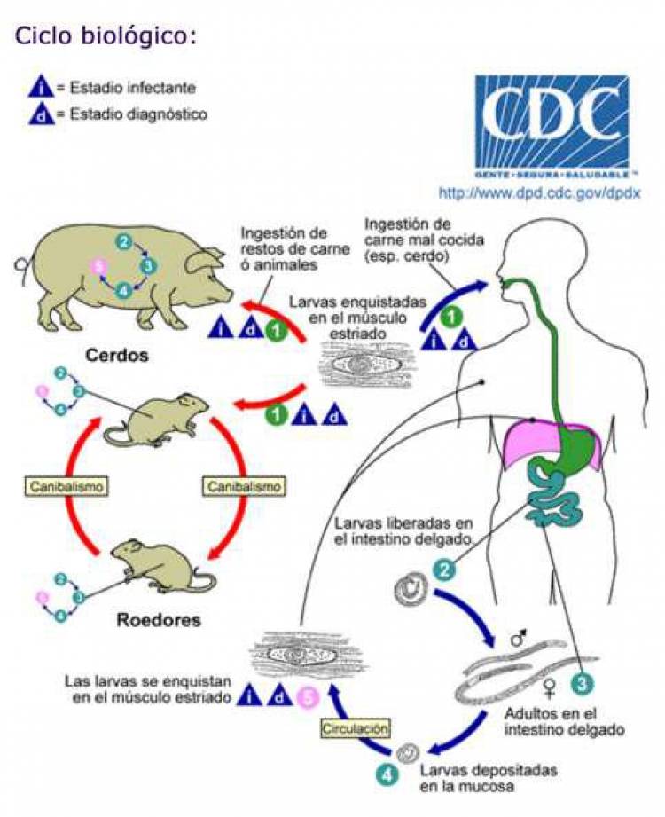 Triquinosis, cuidados esenciales 